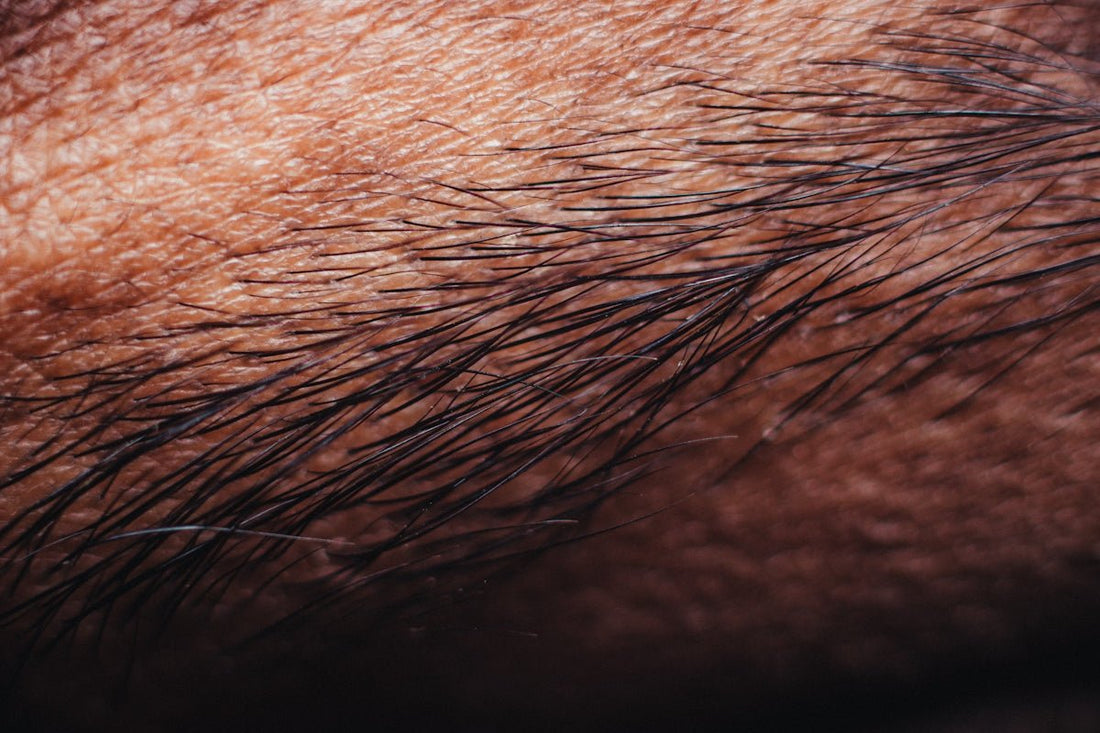 Educational Insights on the Latest IPL Laser Hair Removal Technologies. - MomDaughts UAE