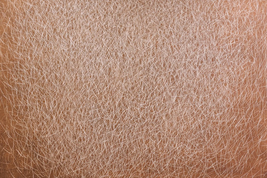 Laser Hair Removal with IPL How it Compares and Why it Matters - MomDaughts UAE