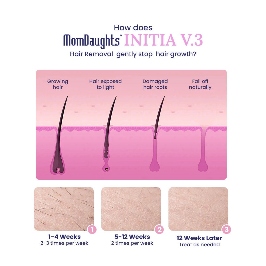 MomDaughts' INITIA V.3 Cooling IPL Laser Hair Remover - MomDaughts UAE